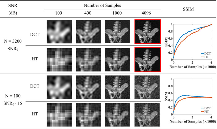 Improving single pixel imaging performance in high noise condition by under-sampling